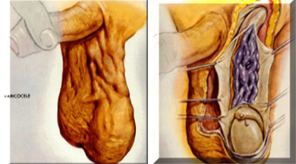 Side effects of steroids men's health